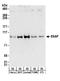 Ubiquitin Protein Ligase E3A antibody, A300-351A, Bethyl Labs, Western Blot image 