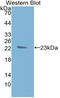 TIMP Metallopeptidase Inhibitor 1 antibody, abx131864, Abbexa, Western Blot image 