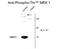 Mitogen-Activated Protein Kinase Kinase 1 antibody, GTX82656, GeneTex, Western Blot image 