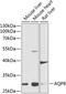 Aquaporin-8 antibody, 23-646, ProSci, Western Blot image 