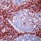 CD5 Molecule antibody, GTX79428, GeneTex, Immunohistochemistry frozen image 