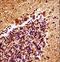 Mitogen-Activated Protein Kinase Kinase 4 antibody, LS-C164445, Lifespan Biosciences, Immunohistochemistry paraffin image 