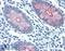 Mucin 4, Cell Surface Associated antibody, LS-B2449, Lifespan Biosciences, Immunohistochemistry paraffin image 