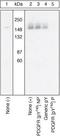 Platelet Derived Growth Factor Receptor Alpha antibody, 44-1006, Invitrogen Antibodies, Western Blot image 