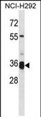 Transmembrane Serine Protease 12 antibody, PA5-71965, Invitrogen Antibodies, Western Blot image 