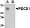 Programmed Cell Death 1 antibody, PA5-20350, Invitrogen Antibodies, Western Blot image 