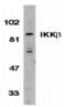 Inhibitor Of Nuclear Factor Kappa B Kinase Subunit Beta antibody, MBS150822, MyBioSource, Western Blot image 