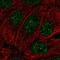 Methyl-CpG Binding Domain Protein 2 antibody, NBP2-56565, Novus Biologicals, Immunocytochemistry image 