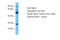 Solute Carrier Family 13 Member 5 antibody, ARP44150_P050, Aviva Systems Biology, Western Blot image 