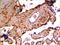 Kallikrein Related Peptidase 13 antibody, NBP2-11748, Novus Biologicals, Immunohistochemistry paraffin image 