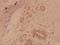 MAPK Activated Protein Kinase 2 antibody, A01193S328, Boster Biological Technology, Immunohistochemistry paraffin image 