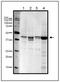Ribonucleotide Reductase Regulatory Subunit M2 antibody, GTX00888, GeneTex, Western Blot image 
