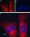 Transmembrane Protein 38A antibody, PA5-77754, Invitrogen Antibodies, Immunocytochemistry image 