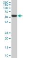 Receptor Interacting Serine/Threonine Kinase 2 antibody, H00008767-M01, Novus Biologicals, Western Blot image 