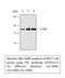 Protein Kinase C Alpha antibody, STJ95117, St John