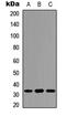 Protein Phosphatase 1 Regulatory Inhibitor Subunit 1B antibody, GTX55025, GeneTex, Western Blot image 