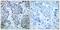 Mitogen-Activated Protein Kinase Kinase 4 antibody, GTX50226, GeneTex, Immunohistochemistry paraffin image 