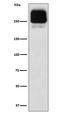 ATP Binding Cassette Subfamily C Member 2 antibody, M00974, Boster Biological Technology, Western Blot image 