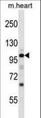 Natriuretic Peptide Receptor 1 antibody, LS-C164506, Lifespan Biosciences, Western Blot image 