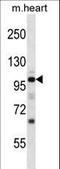 NPR-A antibody, LS-C164506, Lifespan Biosciences, Western Blot image 