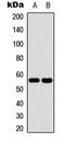 Cytochrome P450 Family 2 Subfamily C Member 19 antibody, LS-C358462, Lifespan Biosciences, Western Blot image 