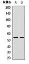 Glucagon-like peptide 1 receptor antibody, LS-C356066, Lifespan Biosciences, Western Blot image 