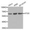 Autophagy Related 5 antibody, abx000592, Abbexa, Western Blot image 