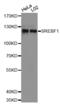 Sterol Regulatory Element Binding Transcription Factor 1 antibody, abx002255, Abbexa, Western Blot image 