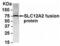 Solute Carrier Family 12 Member 2 antibody, XW-8138, ProSci, Western Blot image 