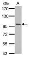 RNA Binding Motif Protein 10 antibody, PA5-30270, Invitrogen Antibodies, Western Blot image 