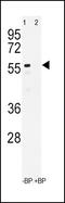 Cytochrome P450 Family 3 Subfamily A Member 4 antibody, 63-204, ProSci, Western Blot image 