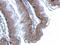 Junction Plakoglobin antibody, PA5-29930, Invitrogen Antibodies, Immunohistochemistry paraffin image 