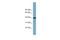 SAM And SH3 Domain Containing 3 antibody, A14755, Boster Biological Technology, Western Blot image 