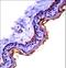 Cystatin A antibody, LS-C167108, Lifespan Biosciences, Immunohistochemistry paraffin image 