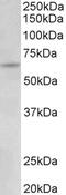Solute Carrier Family 26 Member 6 antibody, 43-165, ProSci, Western Blot image 