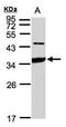 Intercellular Adhesion Molecule 2 antibody, PA5-21778, Invitrogen Antibodies, Western Blot image 