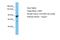 CASK antibody, A30070, Boster Biological Technology, Western Blot image 