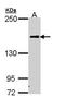 Complement C5 antibody, GTX111625, GeneTex, Western Blot image 