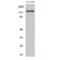 EPH Receptor B6 antibody, LS-C383381, Lifespan Biosciences, Western Blot image 