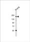 Macrophage Stimulating 1 Receptor antibody, PA5-71878, Invitrogen Antibodies, Western Blot image 