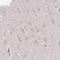 DIMT1 RRNA Methyltransferase And Ribosome Maturation Factor antibody, NBP2-30659, Novus Biologicals, Immunohistochemistry frozen image 