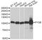 Glycogen Phosphorylase B antibody, LS-C748582, Lifespan Biosciences, Western Blot image 