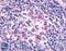 Fms Related Tyrosine Kinase 3 antibody, LS-A7147, Lifespan Biosciences, Immunohistochemistry paraffin image 
