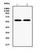 Solute Carrier Family 1 Member 2 antibody, RP1065, Boster Biological Technology, Western Blot image 