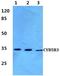 DIA1 antibody, A03487, Boster Biological Technology, Western Blot image 