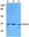 Cytochrome B5 Reductase 3 antibody, A03487, Boster Biological Technology, Western Blot image 