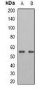 Patatin Like Phospholipase Domain Containing 2 antibody, orb341015, Biorbyt, Western Blot image 