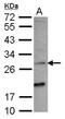 Killer Cell Lectin Like Receptor C2 antibody, NBP2-17085, Novus Biologicals, Western Blot image 