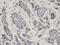 Proteasome Subunit Beta 1 antibody, A06891, Boster Biological Technology, Immunohistochemistry paraffin image 