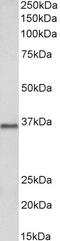 IL-17 antibody, 43-105, ProSci, Enzyme Linked Immunosorbent Assay image 